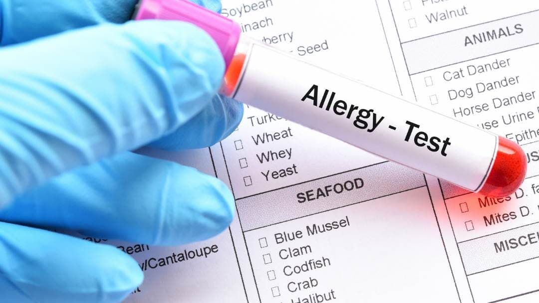 RAST IgE Específica